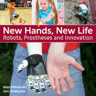 New Hands, New Life: Robots, Prostheses and Innovation